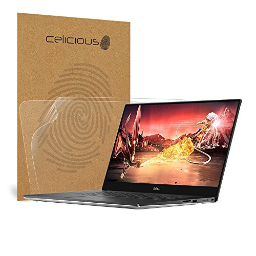 Celicious Matte Dell XPS 15 9560 Non Touch Matter, entspiegelter Displayschutz – [2 Stück]