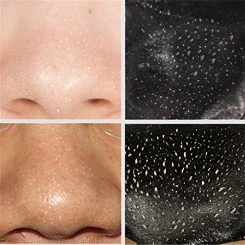 Oshide 10 Stück Black Head Peel Off Maske Porenreinigung Gesichtsmaske - 6