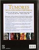 Image de Tumores de la columna vertebral (+CD-rom)