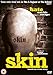 Skin (2008) [ Origine UK, Nessuna Lingua Italiana ]