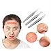 FEITONG 3pcs Curved Blackhead Comedone Clip Needle Tweezers Pimple Extractor Remover (Silver)