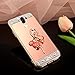 Produktbild Hülle Huawei Mate 10 lite,Silikonhülle für Huawei Mate 10 lite,SaKuLa [Glitzer Strass Handy Ständer Ring Holder]Strass Diamant Spiegel Hülle Mirror Case Silikon Handyhülle für Huawei Mate 10 lite, Bling Glitzer Kristall Glänzend Ultra Dünn Schlank Etui Bumper Case Anti Scratch,Premium Crystal Kratzfest Weiche Soft Flex TPU Tasche Handytasche Cover für Huawei Mate 10 lite-Ballettmädchen Roségold