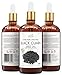 Black Cumin Seed Oil 100 ml 100% Pure & Organic Coldpressed Skin Care Product-Natural Anti-Aging Moisturizer For Men & Women-Professional Acne Scar Removal/Cure For Teens, Girls, Boys-Hydrates & Fades Dark Spots