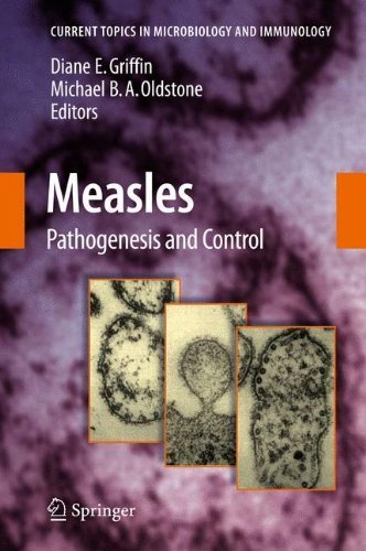 Measles: Pathogenesis and Control (Current Topics in Microbiology and Immunology) (2008-12-12) francais Measles: Pathogenesis and Control (Current Topics in Microbiology and Immunology) (2008-12-12) francais