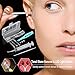 Produktbild Queta Praktisch Pflegeset LED beleuchtet Tonsillenstein Entferner Werkzeug mit Aufbewahrungskiste,1 20 ml Portable 360 Grad drehbar Nasenspray Flasche (Geschenk),1 Edelstahl Ohrlöffel (Geschenk)