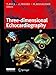 Produktbild 3d-echocardiography
