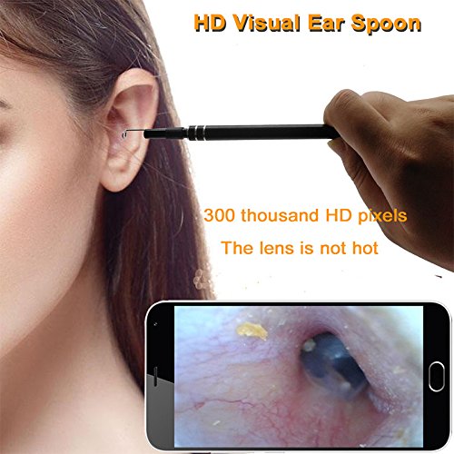 ETbotu Ear Camera Digital LED Otoscope Ear Camera Scope Earwax Removal Kit Ear Wax Cleaning Tool