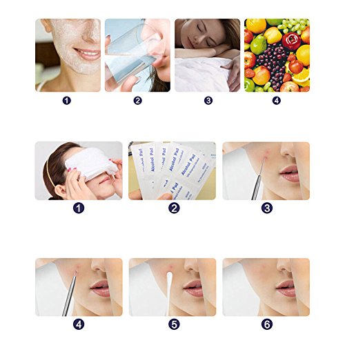 Oshide 5 Stücke Doppelseitig Mitesserentferner Komedonenquetscher Set Aus Edelstahl Gegen Pickel Whiteheads Akne - 9