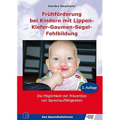 [PDF] Frühförderung bei Kindern mit Lippen-Kiefer-Gaumen-Segel-Fehlbildung KOSTENLOS DOWNLOAD