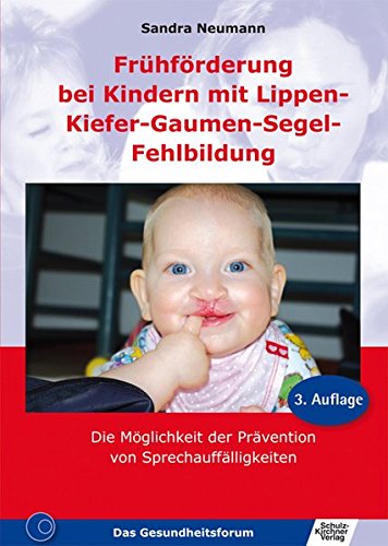 Download Frühförderung bei Kindern mit Lippen-Kiefer-Gaumen-Segel-Fehlbildung Download Frühförderung bei Kindern mit Lippen-Kiefer-Gaumen-Segel-Fehlbildung