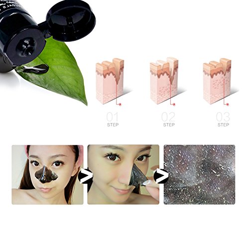 Mitesser Entferner Maske – Vena Beauty Mitesser Entfernungs-Maske, Akne Maske, Reinigungs-Maske, Gesichtsmaske schwarz - 5