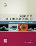 Image de Diagnóstico por la imagen en retina