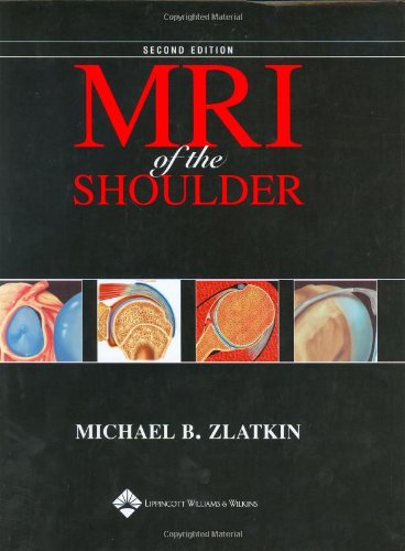 MRI of the Shoulder