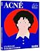 Acné