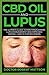 Produktbild CBD Oil And Lupus: The Ultimate Guide To Pain Management, Lupus Management And Improved Overall Wealth For Beginners