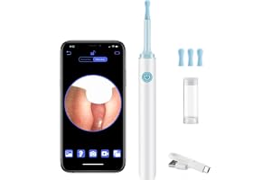 LANMOU Öronrengöring med kamera, 1080P otoskop | 6 lysdioder öronrengörare, 4 silikonfästen, IP67, 240 mAh för hemmet eller på språng