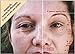 Dermawand - UK 220-240V 50 Hz UK PLUG - Derma Wand For Wrinkles | Puffy Eyes | Skin Tightening | Saggy Skin | Non-Surgical Face Lift | Blemishes | RF Treatment | Ships from the UK by Amazon