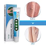 crema para activar circulacion piernas 【FUNCIÓN】 - Aliviar la hinchazón. dolor. Nódulo causado por vasculitis y varices.