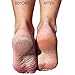 Solrngen Foot Rasp Callus Callous File Dry Hard Dead Skin Corn Remover Shaver...