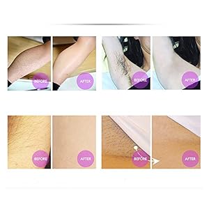 Careshine Electric PRO IPL Natural Magic Blu-ray Thermal Epilator Hair Removal Device(Pink) - Image 7