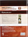 Image de Signos cutáneos de las enfermedades sistémicas