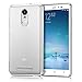 Produktbild KKtick Redmi Note 3 UltraSlim Hülle TPU Durchsichtig Crystal Clear Case Weiches Silikon Schutzhülle Tasche Bumper Cover Handyhülle für Xiaomi Redmi Note 3