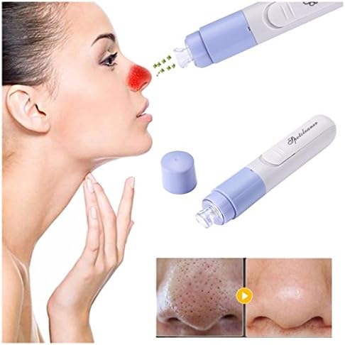Electric Facial Pore Cleaner Vacuum Suction Blackhead Removal Acne Pore Skin Care Cleansing Tool Fuibo