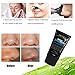 Aliver Activated Natural Charcoal Black Mask Blackhead Peel Off Remover Cream Deep Skin Clean Purifying Peel Acne Mud Nose and Face Mask 50gms Bottle (1#) (#2)