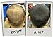 3D Hair Loss Fibres for Thinning Hair Medium Brown 35g