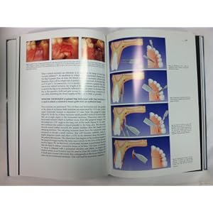 Mucogingival surgery