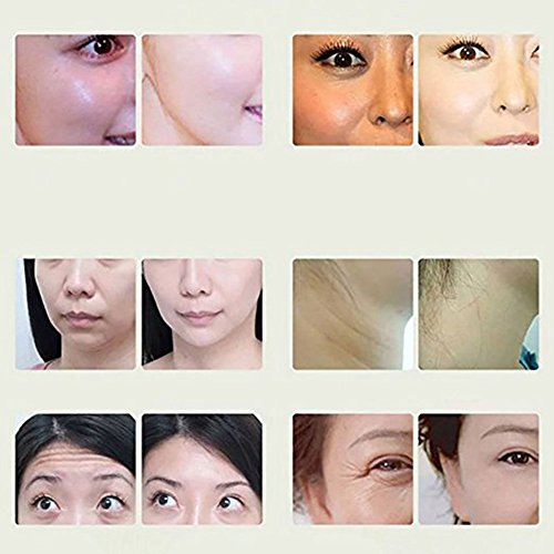 Petansy Hautpflege Deep Cleansing Maske Whitening Moisturizing Carbonated Bubble Maske - 2