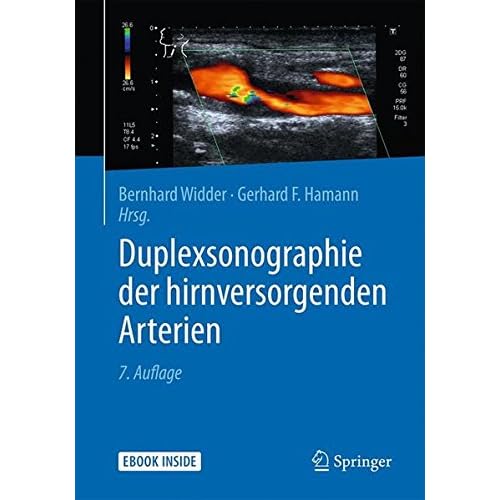 Duplexsonographie der hirnversorgenden Arterien Duplexsonographie der hirnversorgenden Arterien