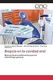 Image de Biopsia en la cavidad oral