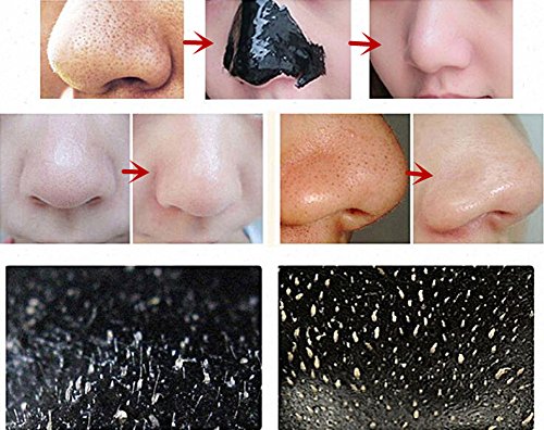 Mitesser Maske, Black Head Maske, Peel Off Maske, Mitesser Entferner Maske, Gesichtsmasken Schwarz, Blackhead Remover, CIDBEST® 12 Stück Schwarz Purifying Peel off Maske, Tiefenreinigende Schwarze Maske , Anti Akne Öl-Kontrolle Reinigungsmaske , anti Akne Reißen-Typ Mask Blackhead Killer + 1pcs Akne Werkzeug - 7