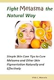 Image de Fight Melasma the Natural Way- Simple Skin Care Tips to Cure Melasma and Other Skin Pigmentation Naturally and Effectively (English Edition)