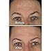 Microderm MD Skincare System with Extra 100 x Black Wool Filters