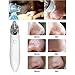 Electronic Facial Pore Cleaner,eTTgear Nose Blackhead Cleaner Acne Remover Tool(White)