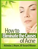 Image de How to Eliminate the Causes of Acne (English Edition)