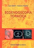 Image de Ecoendoscopia toracica