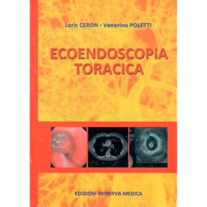 Ecoendoscopia toracica