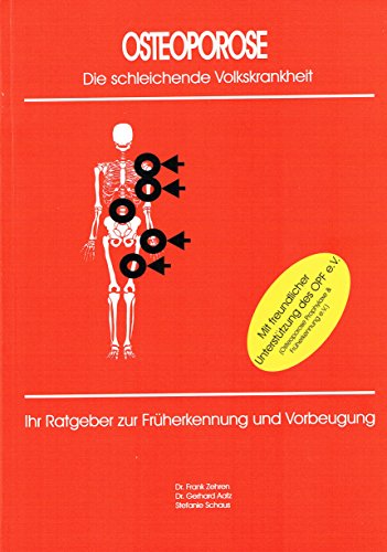 Preisvergleich Produktbild OSTEOPOROSE - Die schleichende Volkskrankheit
