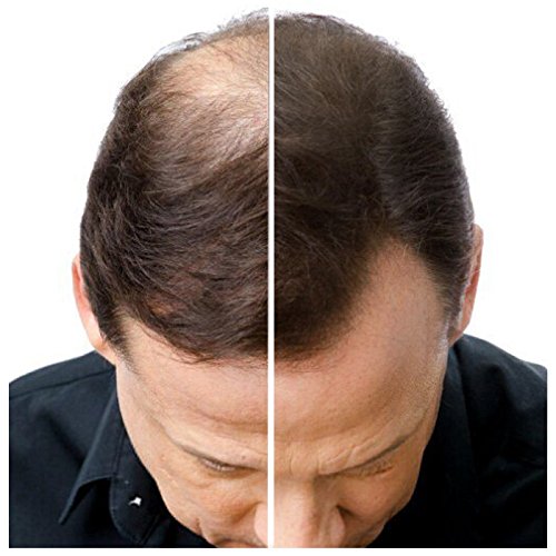 -26g- IMPERIO STREUHAAR zur HAARVERDICHTUNG & VOLLEM HAAR in Sekunden. SCHÜTTHAAR-100% Natur! (DUNKELBRAUN) - 2