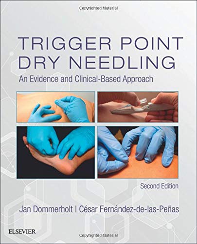 Trigger Point Dry Needling -2E