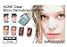 Acne Clear - Micro Dermabrasion Cloth - Acne Treatment Face Cloth