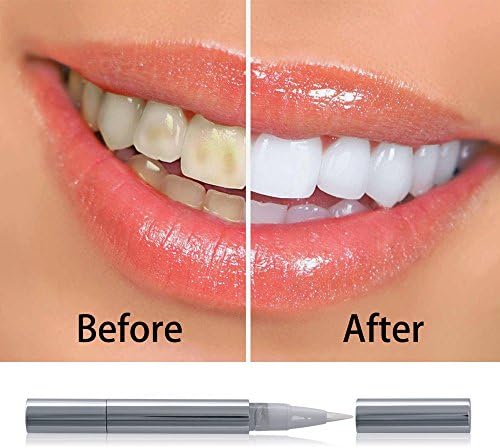 SENRU Teeth Whitening Pen,Portable and Effect,Pack of 2