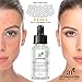 Art Naturals® Anti Acne Serum Treatment 30ml- Dermatologist Tested Product, Made with Revolutionary Evermat® & Organic Ingredients to Help Control & Get Rid of Acne - Best Pore Minimizer -For all Ages