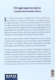 Image de Cirugía laparoscópica a través de incisión única
