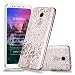 Produktbild HopMore Xiaomi Redmi 5 Plus Hülle Silikon Transparent Durchsichtig Hüllen Clear Muster Design Bumper Ultra Dünn Slim TPU Xiaomi Redmi 5 Plus Handyhülle Kawaii One Piece Schutzhülle Case Cover - Weiße Mandala