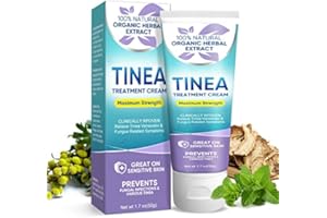 Memonotry Antifungal Cream - Tinea Versicolor Treatment, Athletes Foot & Ringworm Treatment, Itchy Skin Relief, 50g(Antifungal Cream)