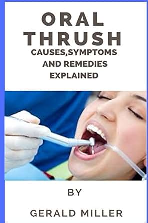 Oral thrush: oral thrush treatment adult candida medicine for relief